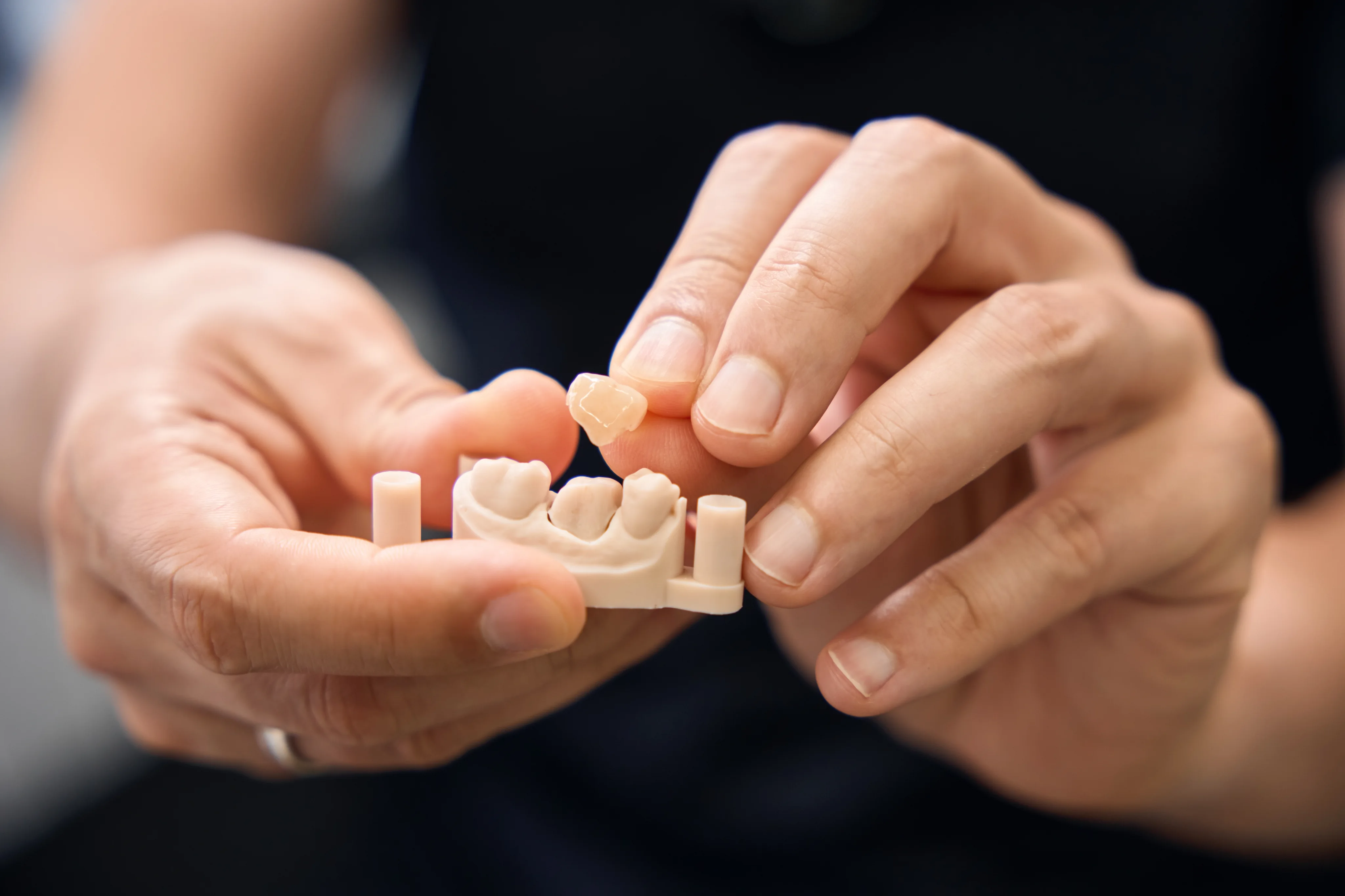Dental
Crowns at Sunshine Dentistry in San Diego