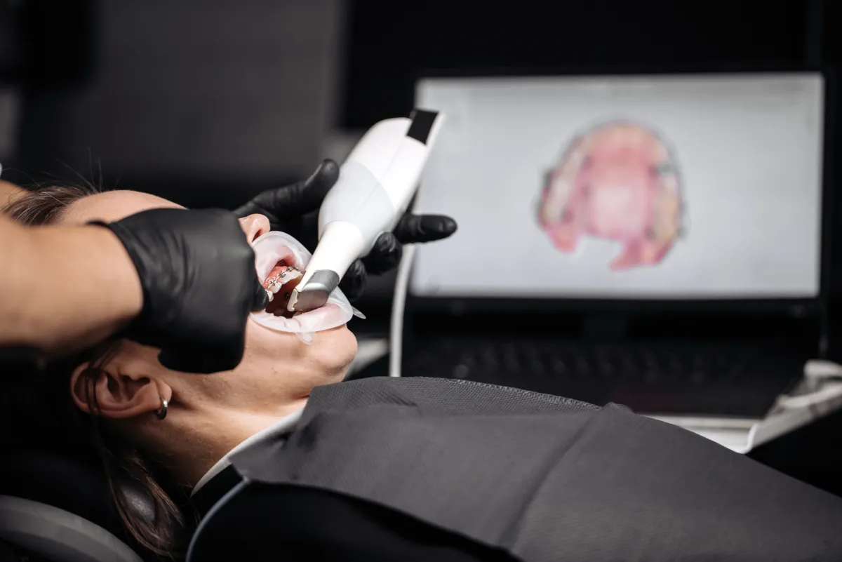3Shape Trios digital scanner in use